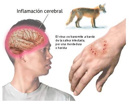 ¿Qué hacer si me muerde un animal con rabia?
